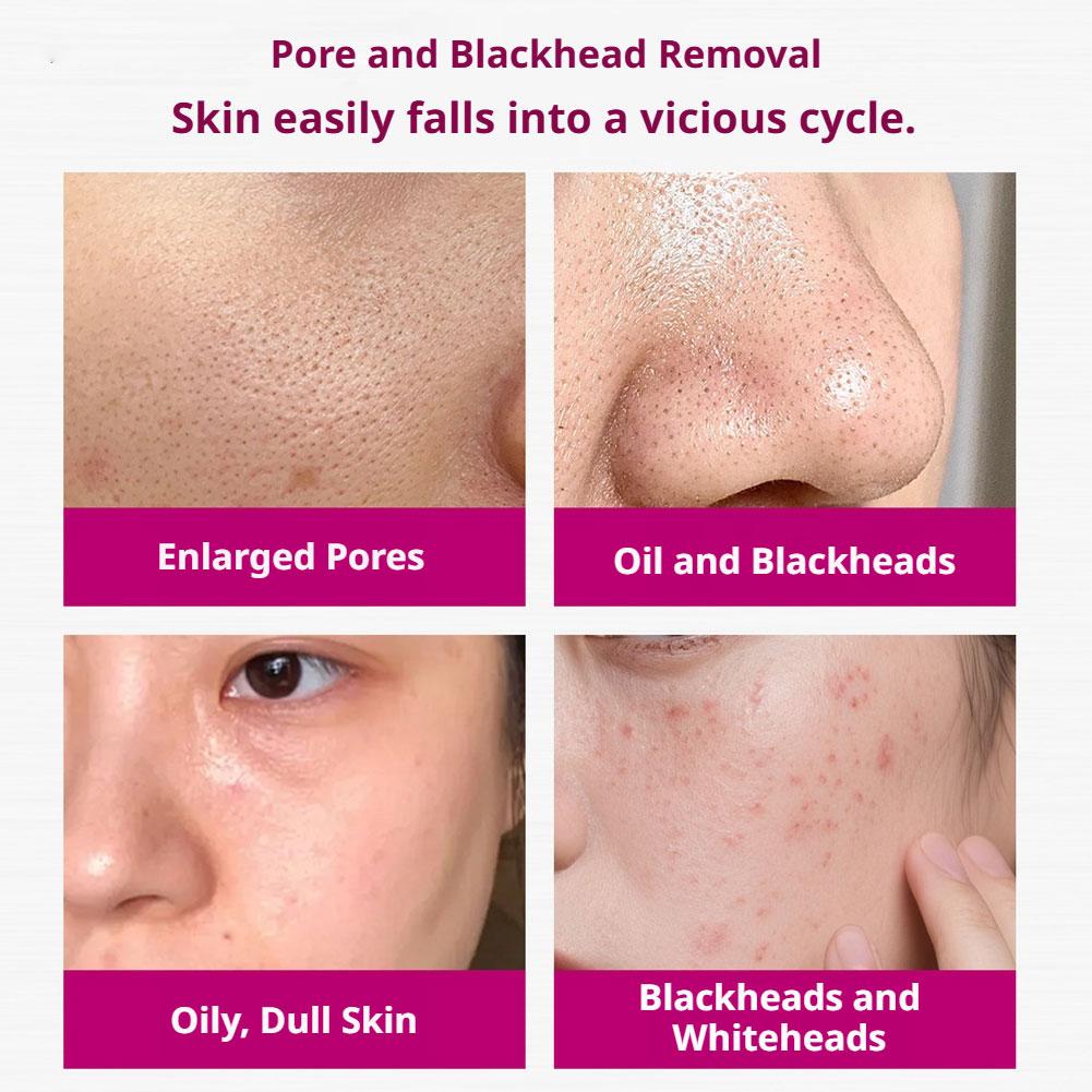 Salicylic Acid Shrink Pores Se - Aha Bha Exfoliant recension och pris