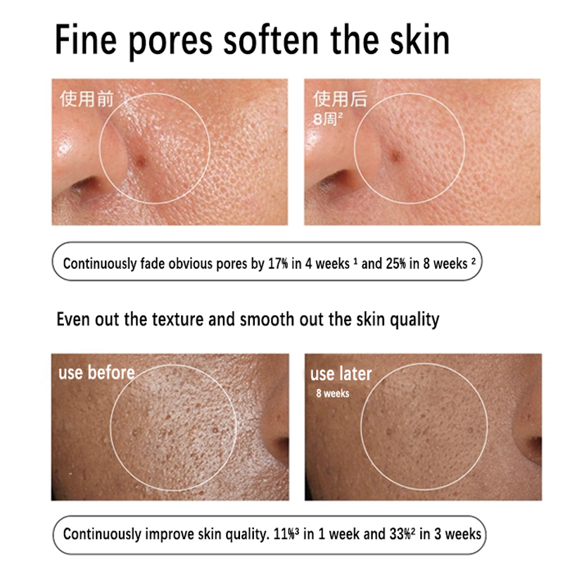 Aloe 2% + NAG 2% Solution Seru - Aha Bha Exfoliant recension och pris