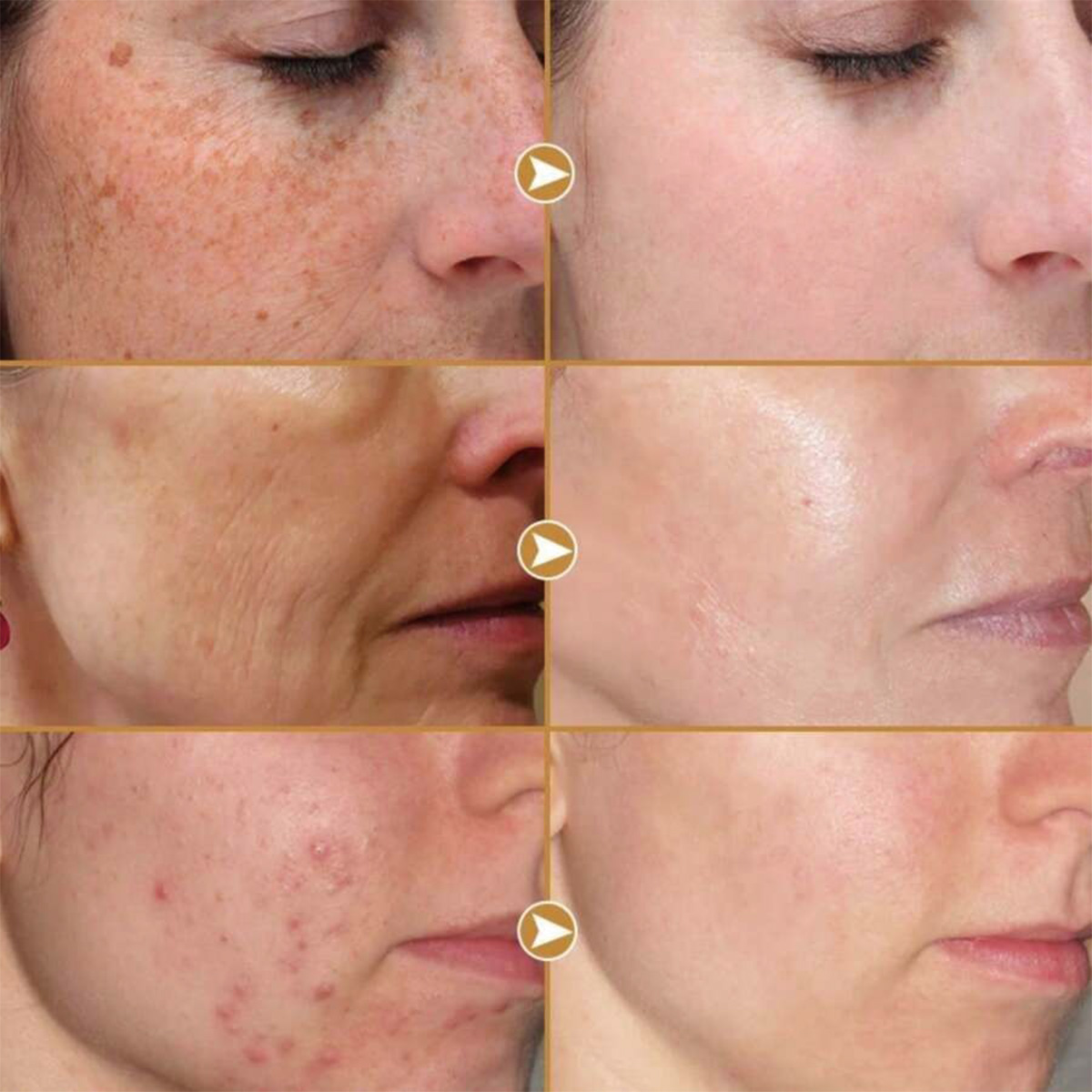 TRSTAY Peptide Compound Essenc - Peptide Neck Cream recension och pris